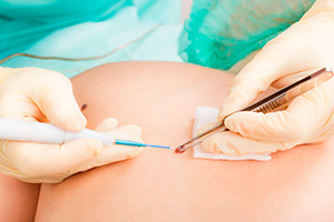 Dermatologia cirúrgica