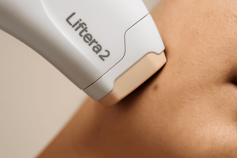 Liftera 2: o ultrassom coreano para efeito lifting sem cirurgia
